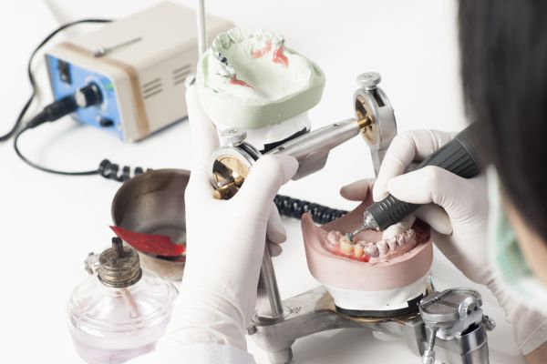 Things You Should Know About Getting A Dental Crown