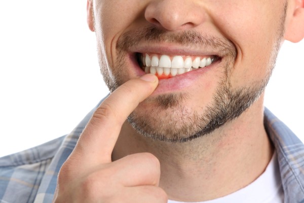 Dental Practice FAQs: How Gum Disease Is Treated