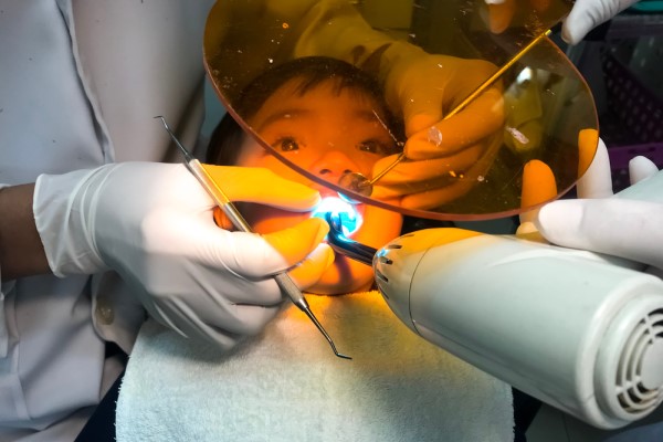 Are Dental Sealants Used To Treat Sensitive Teeth?