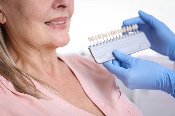 The Process Of Getting Dental Veneers: What To Expect
