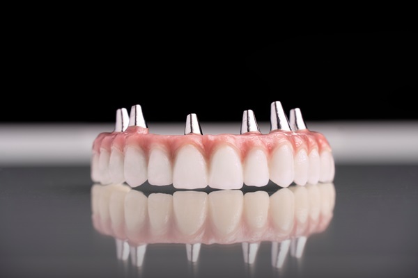 Tips To Extend The Longevity Of Implant Supported Dentures