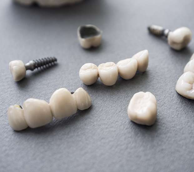 Benicia The Difference Between Dental Implants and Mini Dental Implants