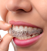 Clear Aligners - Almost Invisible Braces Benicia, CA