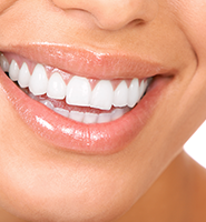 Teeth Whitening Services Benicia, CA